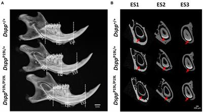 Enamel Defects Associated With Dentin Sialophosphoprotein Mutation in Mice